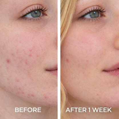 Enriched Face Foaming Cleanser with Chamomile & Witch Hazel