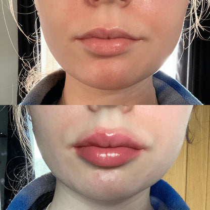 Plump It! No Needles Lip Boosting Trio